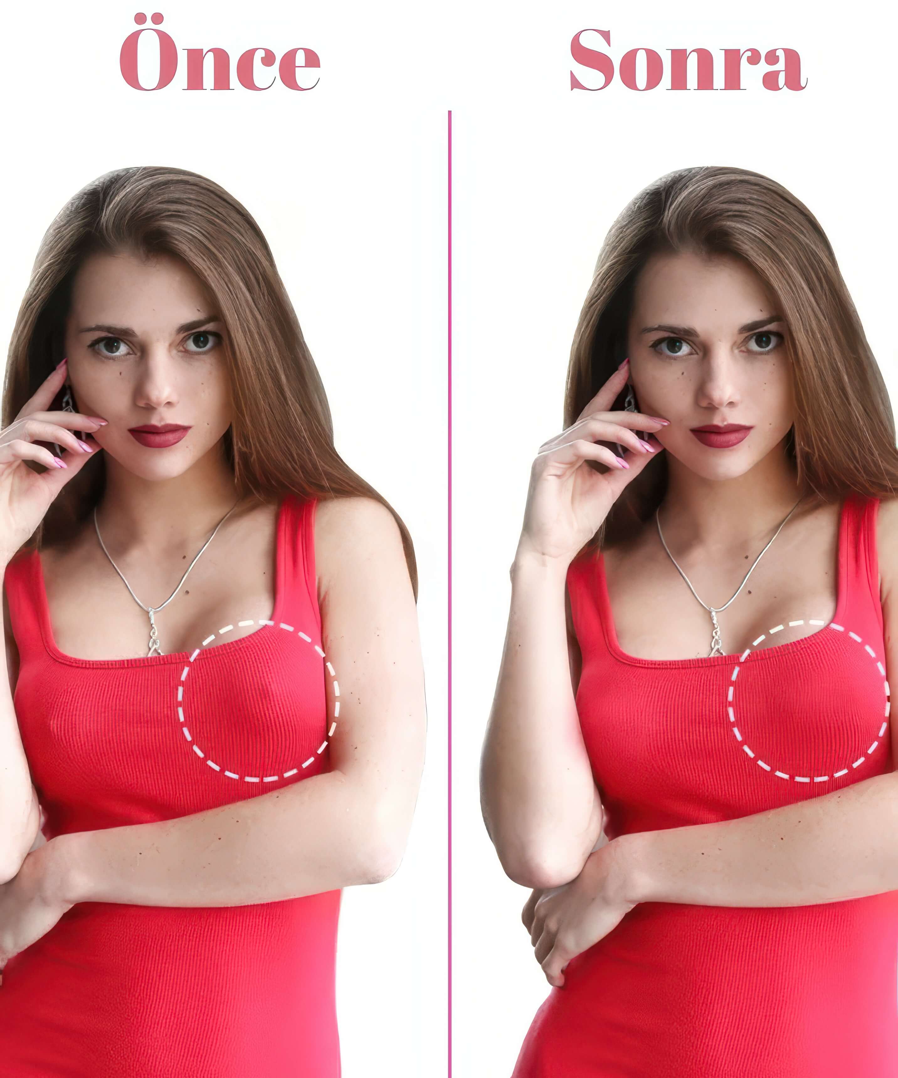 Silikon Göğüs Ucu Kapatıcı - 3